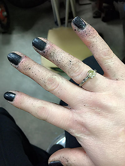 Samantha's hands all spotted up